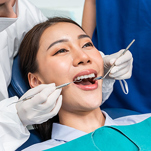 Dental Fillings Treatment